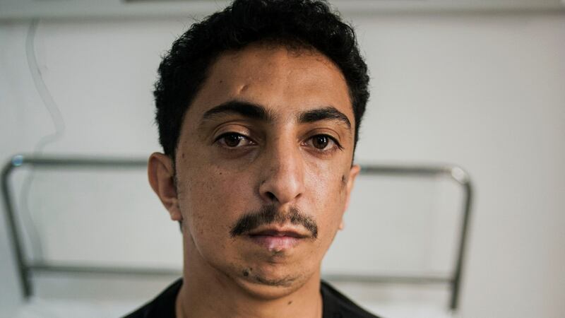 Waddah Sinan from Yemen, who  underwent reconstructive surgery on his jaw, at the MSF hospital in Amman. Photograph: Ted Nieters
