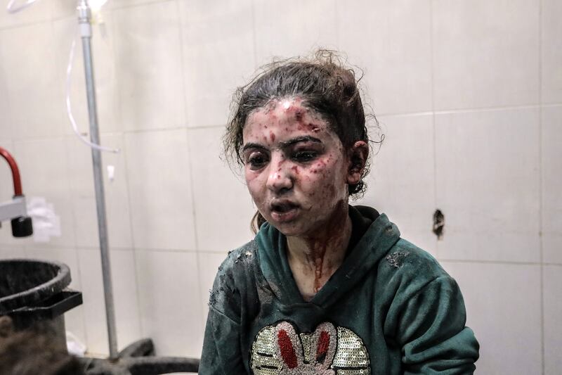A Palestinian child injured in Israeli air strike  awaits treatment at Nasser Medical Hospital in Khan Yunis, Gaza, on Thursday.(Photograph: Ahmad Hasaballah/Getty Images