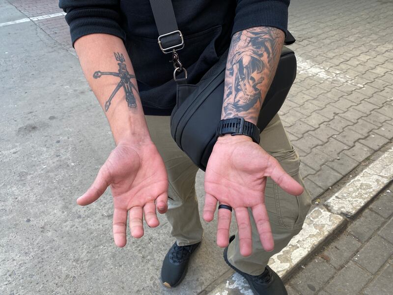 Shelby was honourably discharged from the US marine corps after injuring his hand throwing a grenade. Photograph: Lara Marlowe