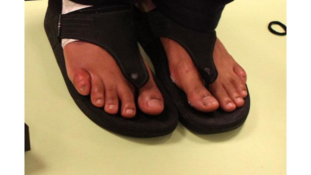 David Haye of England shows his broken toe to Wladimir Klitschko during the press conference after their heavyweight unification fight at the Imtech Arena in Hamburg, Germany. Photograph: Scott Heavey/Getty Images