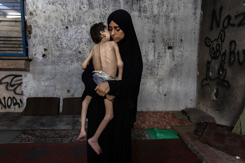 Samah Matar holds her son Yousef (6) north of Gaza City on Thursday. Yousef has cerebral palsy and severe malnutrition. He weighed about 29 pounds before the war but now weighs about 20 pounds. Photograph: Saher Alghorra/The New York Times
                      
