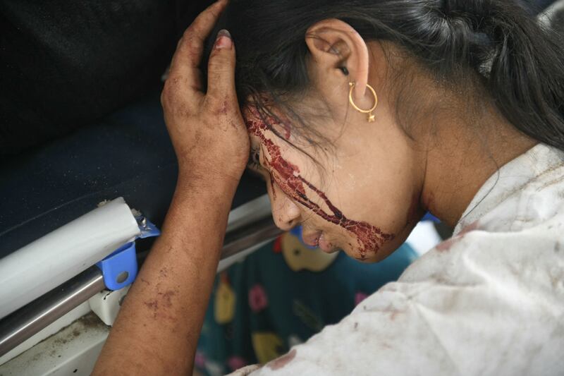 Myanmar and Thailand earthquake: An earthquake survivor in hospital in Naypyidaw. Photograph: Sai Aung Main/AFP       