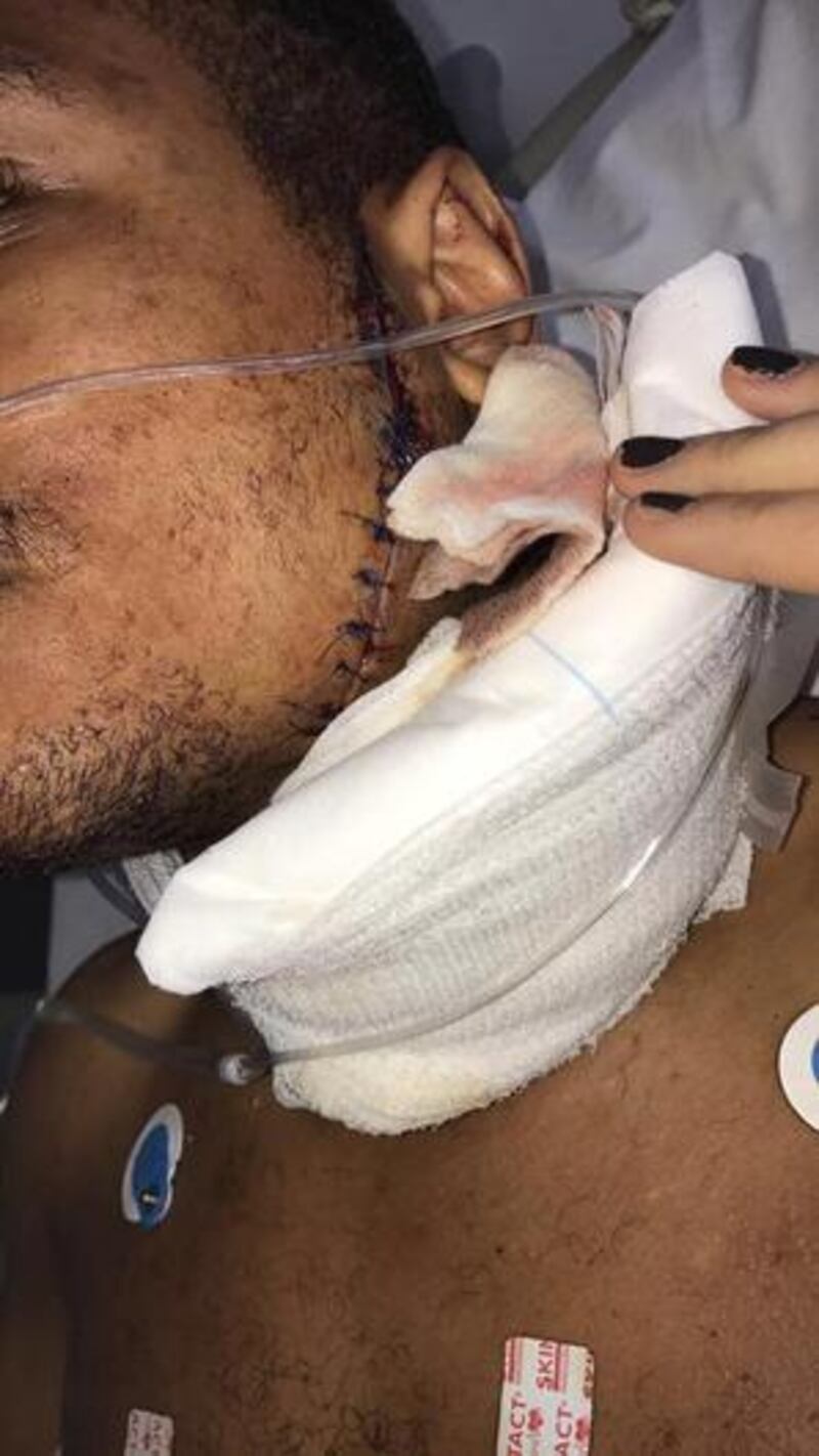 Caoimhin Agyarko Hynes was stabbed outside a fast-food outlet in Belfast’s city centre in 2017, leaving him with a seven-inch scar.   Photograph: Eoaghan Junior
