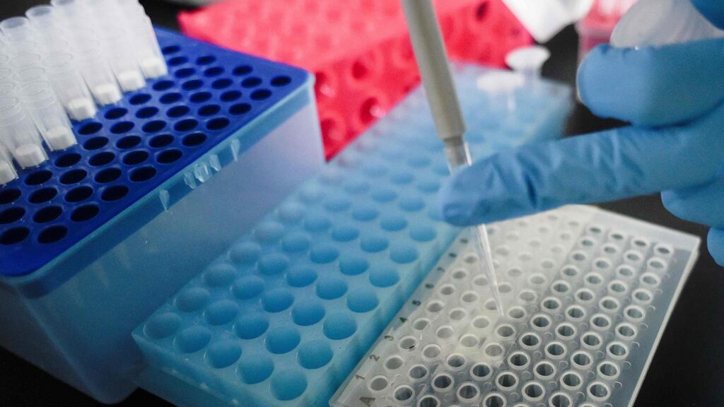 Sensitivity and specificity are key in a test: the former captures all true positive results; the latter rules out all true negatives.