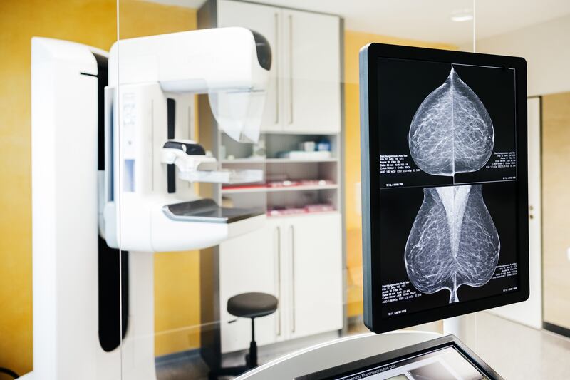 AI won’t make radiologists obsolete, said Dr Ritse Mann. Photograph: Getty Images