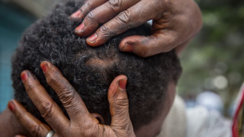A victim shows a scar from his time with smugglers in Libya, following a hearing in the smuggler trials. Photograph: Sally Hayden