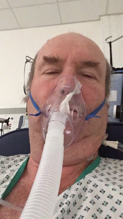 John had to wear this mask for the first couple of days after waking from the 12-hour operation. He had been asleep for 16 hours.