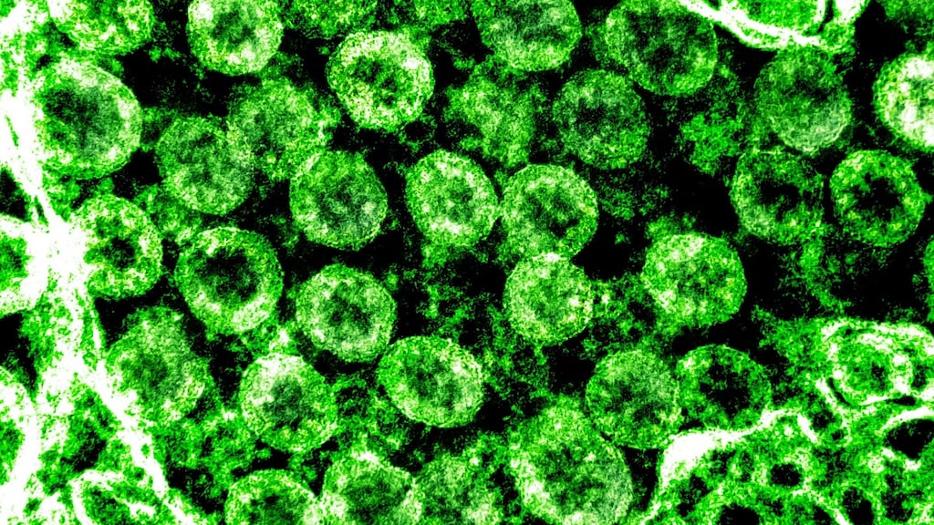 The virus that causes Covid-19: companies and governments have been calling off big gatherings. Photograph: National Institutes of Health/EPA