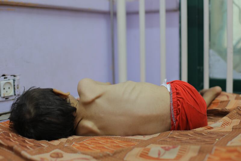 A child at the Al-Aqsa Martyrs Hospital in Deir al-Balah, Gaza Strip. Photograph: Hassan Jedi/Anadolu via Getty Images