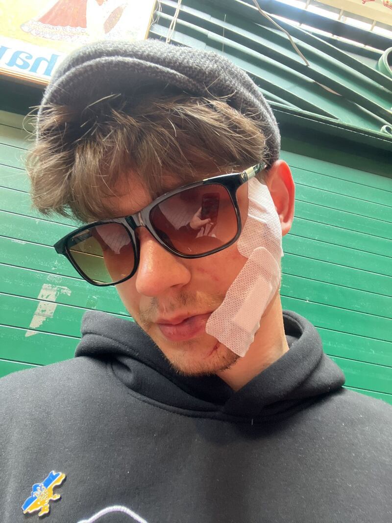 Ukrainian Oleksandr Hrekov was set upon, apparently by a five-strong group – two men and three women – on Eden Quay in Dublin city centre, just around the corner from the Abbey, last Saturday night.  Photograph: Courtesy Reach PLC