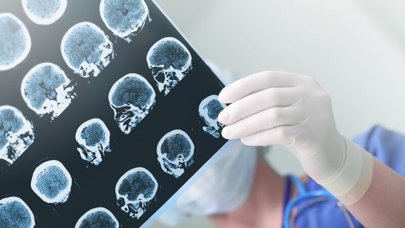 In an ideal scenario, stroke is identified quickly and the patient  whisked to a specialised hospital where the waiting medical team administer clot-busting drugs, and then scan the brain so the location of the clot can be established. Photograph: iStock