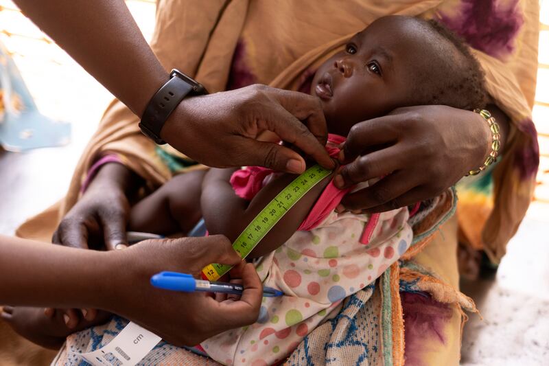 A baby is checked for malnutrition at the Médecins Sans Frontières hospital in Adre’s refugee camp, near the border with Sudan. Photograph: Chris Maddaloni