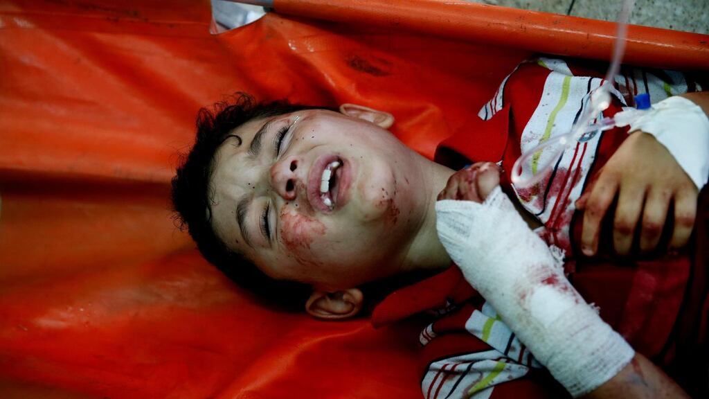 A Palestinian child wounded in an Israeli strike on a compound housing a UN school in Beit Hanoun, in the Gaza Strip, cries in Kamal Adwan hospital in Beit Lahiya yesterday. Photograph: Lefteris Pitarakis/AP