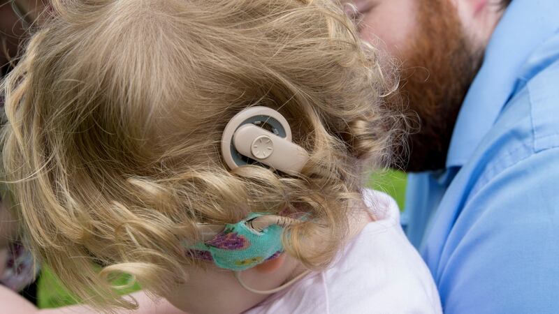 Sadbh White, age 17 months,  with her cochlear implants. Photograph: Brenda Fitzsimons