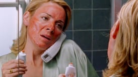 Facial peels in Dublin that won't leave you red-faced