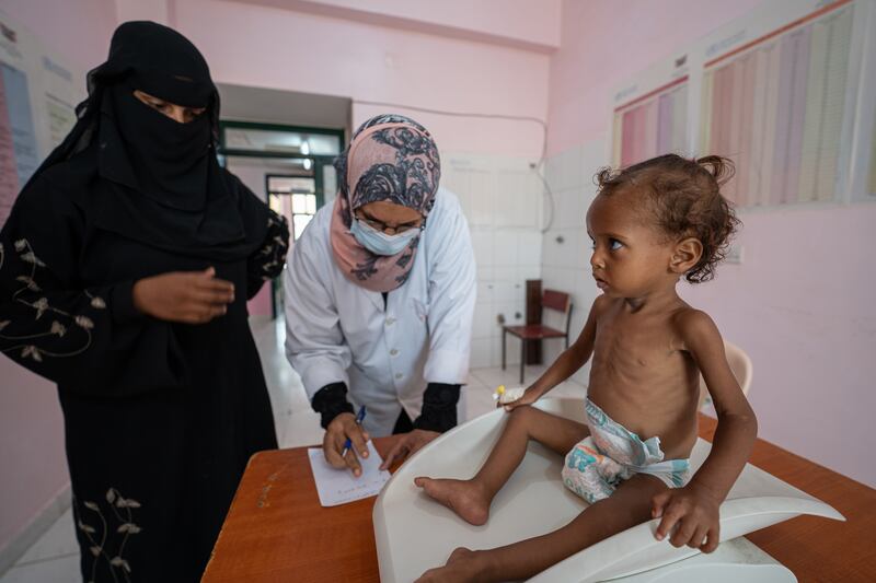 Ghosson’s weight is measured and compared to her height to evaluate how severely malnourished she is. Photograph: Saleh Hayyan/Unicef