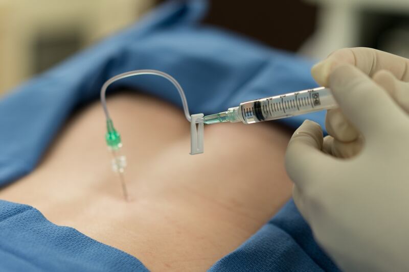 Drug could halve number of women needing epidurals during labour