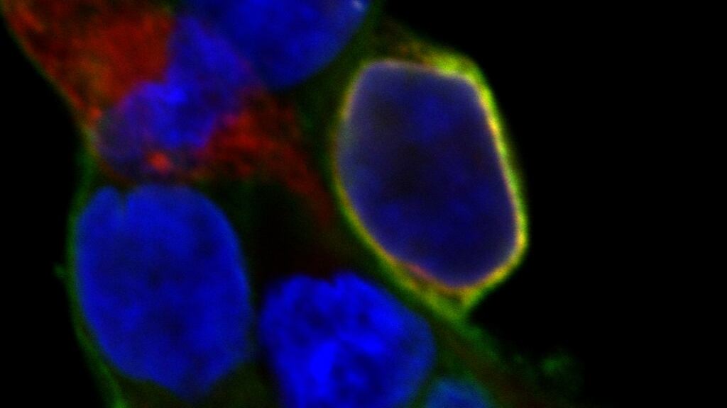Harmless yellow fluorescence sends a light signal to show that a drug is interacting with a drug, something that shows how a drug is performing. The use of fluorescence removes the need to use radioactivity to achieve the same result.