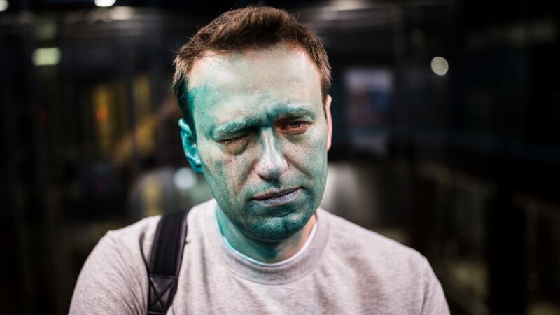 Russian opposition leader Alexei Navalny  after unknown attackers doused him with green fluid outside a conference venue in Moscow, Russia, late last month. File photograph: Evgeny Feldman/Pool Photo via AP