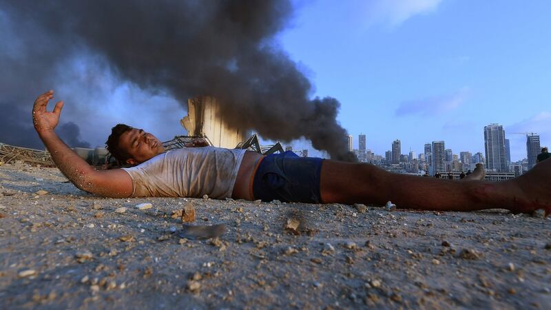 A wounded boy lies on the ground amid debris near the scene of Tuesday’s explosion at Beirut port. Photograph:  AFP via Getty Images