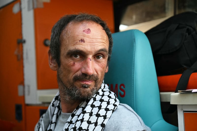 A member of the flotilla with injuries to his face in Istanbul on Thursday. Photograph: Ozan Kose/AFP via Getty
