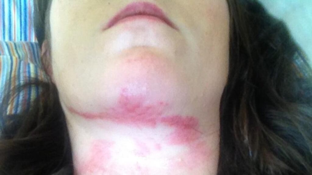 A picture of some the injuries sustained by Monique Kelleher which she posted online.