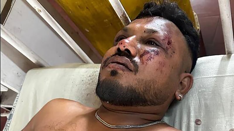 Vishwash Kumar Ramesh, the sole survivor of the Air India crash that killed more than 200 people. Photo: Hindustan Times