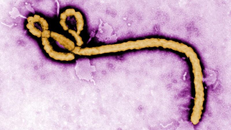 A Centres for Disease Control and Prevention (CDC) handout photo of the ebola virus. Hopes of a breakthrough in the fight against Ebola have been raised by the 100 per cent successful treatment of monkeys with the deadly disease. Photograph: Frederick Murphy/CDC/PA Wire.