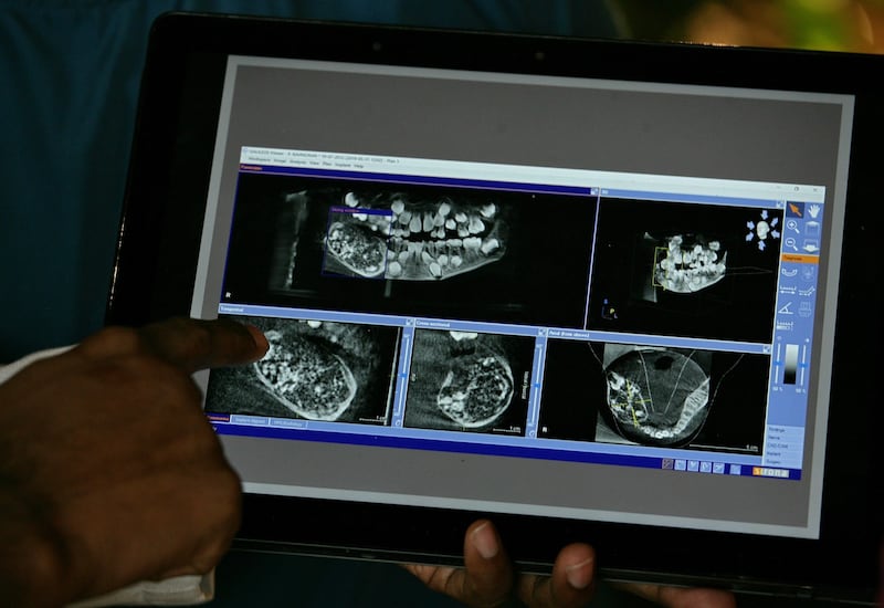 526 teeth: a doctor shows a scan of the boy’s mouth. Photograph: P Ravikumar/Reuters