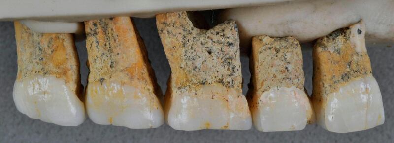 The teeth of Homo luzonensis are consistent with the remains being assigned to a new speciesPhotograph: Florent Detroit/AFP/Getty Images