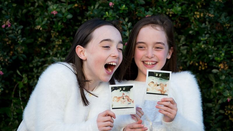 Twins Crea and Kerry Meehan aged 10 from Ballyfermot, Dublin with photos of themselves as premature babies. Photograph: Tom Honan