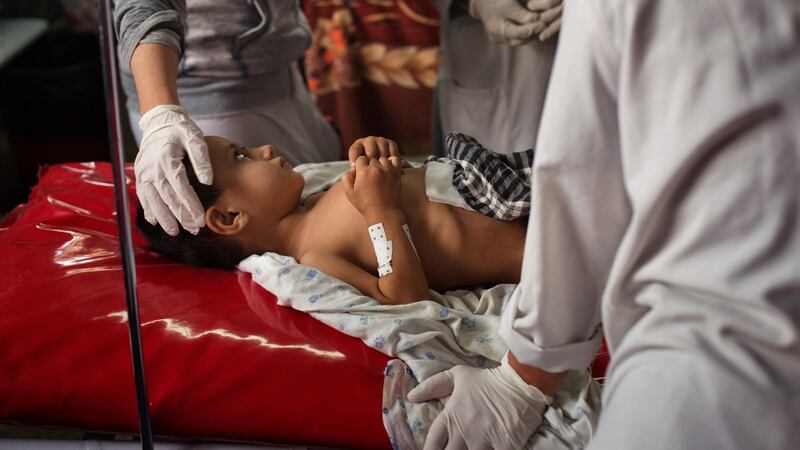Wahidullah, a four-year-old who was at the Doctors Without Borders hospital hit by a United States airstrike in Kunduz, is treated at another hospital in Kabul, Afghanistan, on Saturday.  Photograph:  New York Times