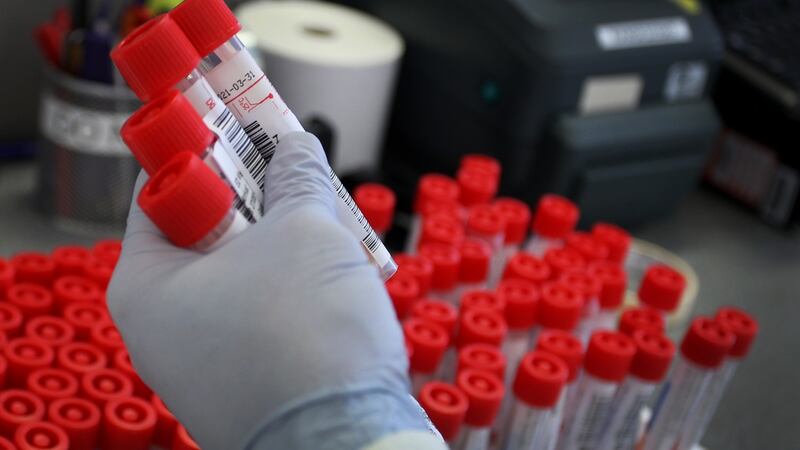 A new plan for Covid-19 testing is to be published on Thursday committing to a 72-hour turnaround time for the the completion of test and contact tracing, as well as the long-promised target of 100,000 tests per week. Photograph: Lisa Maree Williams/Getty Images
