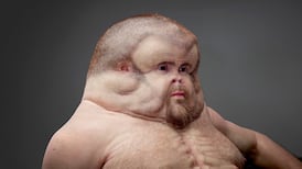 What does perfection look like and why does it make us miserable?