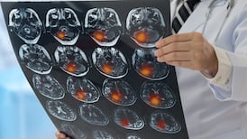 Cancer patients’ own cells used in 3D-printed tumours to test treatments