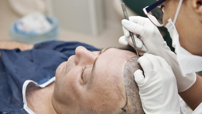 On being told that local anaesthetics  are used, I wonder how badly it hurts. Photographs: iStock