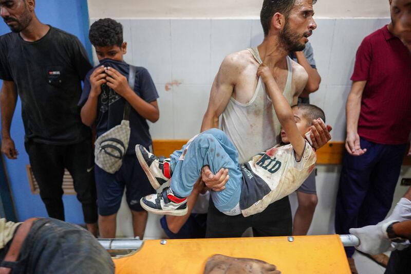 A man carries a child injured during an Israeli bombardment at Nassr hospital in Khan Yunis, on the southern Gaza Strip. Photograph: Bashar Taleb/AFP via Getty 