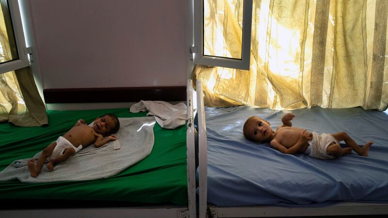 Malnourished children at a clinic in Aslam, Yemen. Photograph: Tyler Hicks/The New York Times