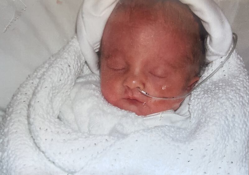 Molly's little sister, who was born with Edwards syndrome