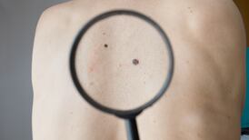 Get that mole checked out