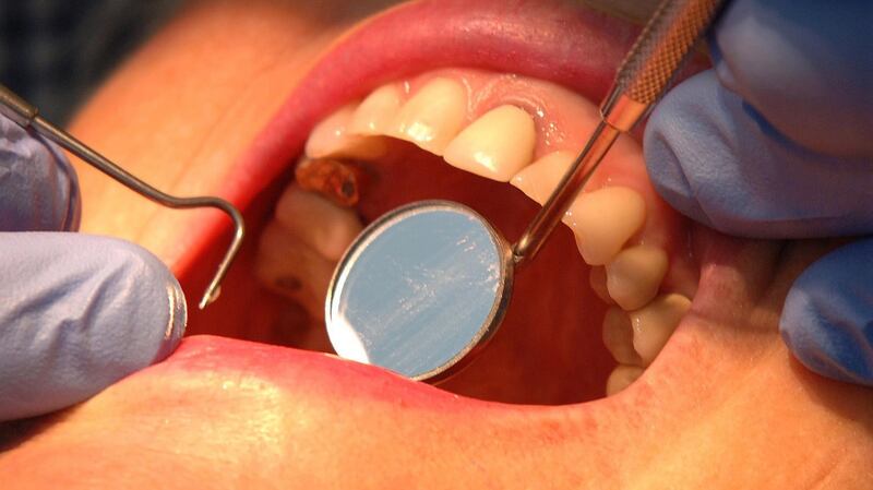 The number of fillings carried out for medical card patients dropped by 37 per cent. Photograph: John Giles/PA Wire
