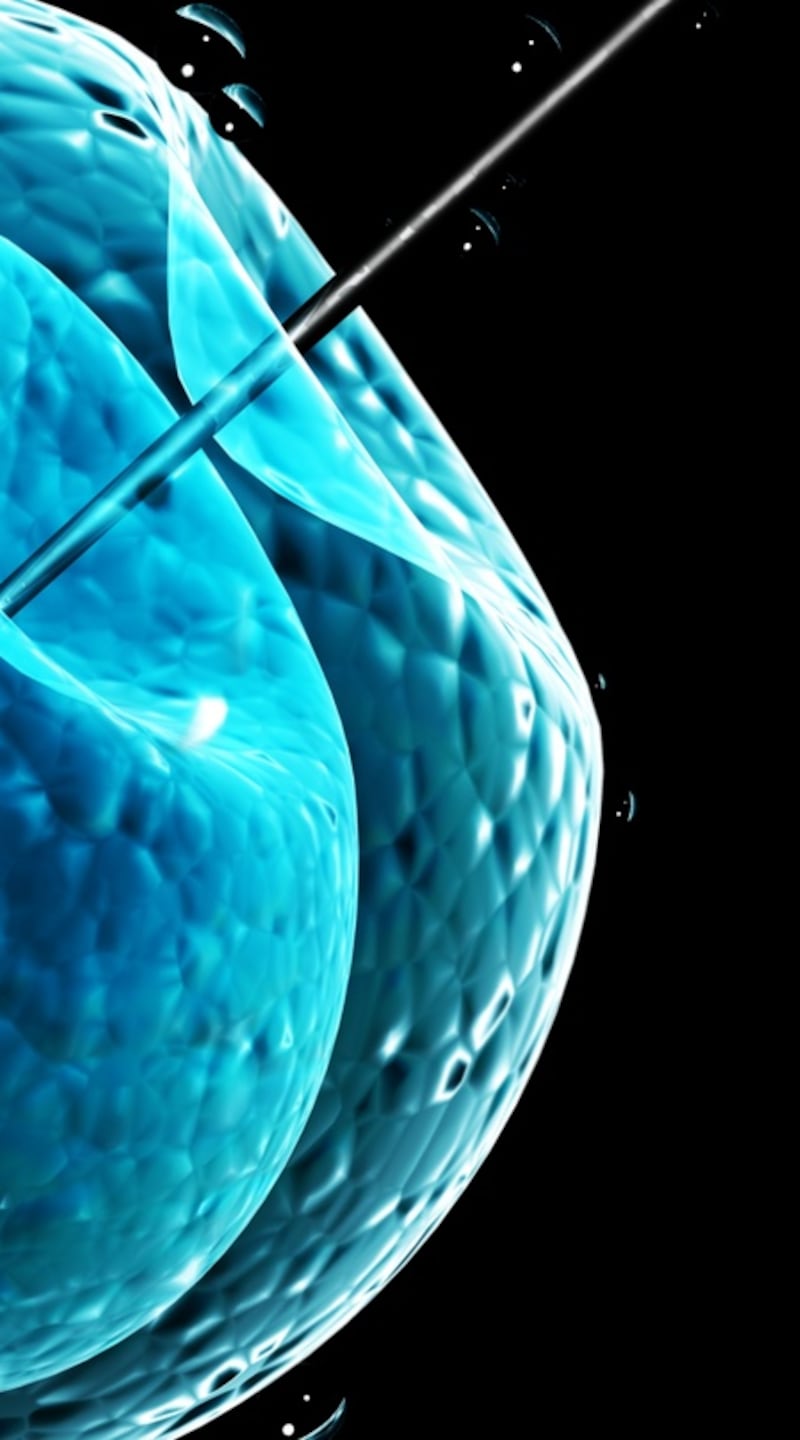 A cycle of IVF usually costs between €6,000 and €10,000 depending on which treatment is required and which clinic you are using. Photograph: iStock