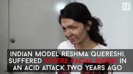 Acid attack model hopes to inspire at NY Fashion Week