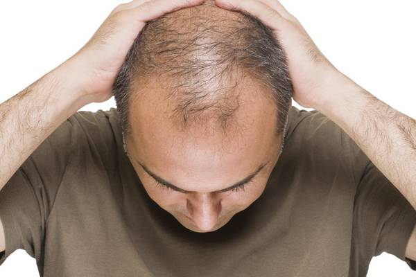 Our son says his hair loss has ruined his life