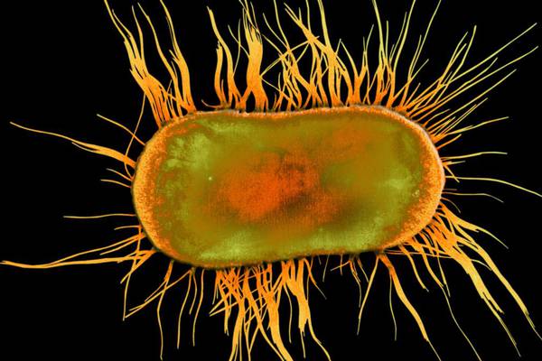 E.coli found in 5% of private water supplies, EPA warns