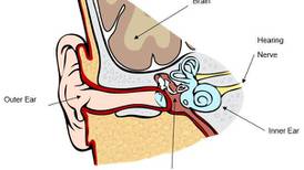 Irish-made tinnitus device cuts symptoms in 80% of patients