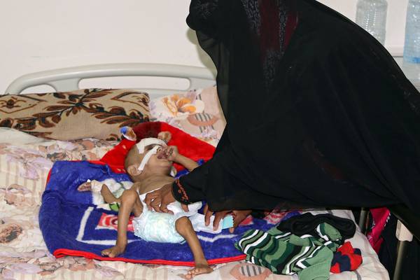 Suspected cholera cases in Yemen hit 1 million – Red Cross