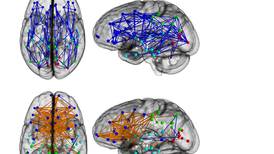 It’s true: male and female brains are wired differently