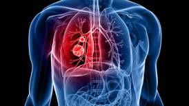 Many Irish people can not list any symptom of lung cancer